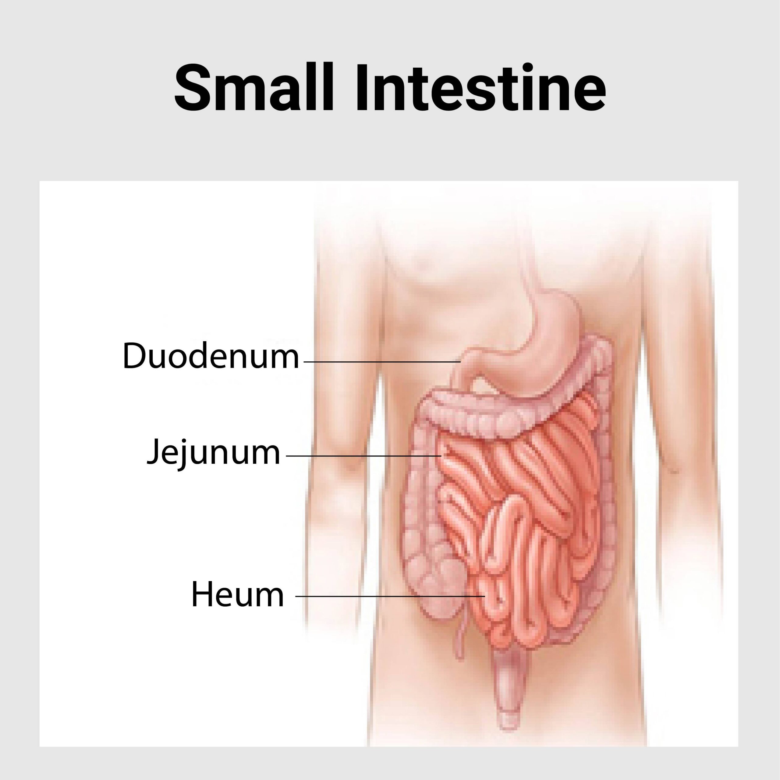 small-intestine-disease-best-gastroenterology-hospital-in-india