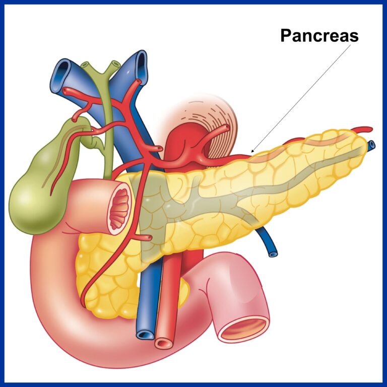 Pancreas Disease - Kaizen Hospital | Pancreatic Cancer Treatment