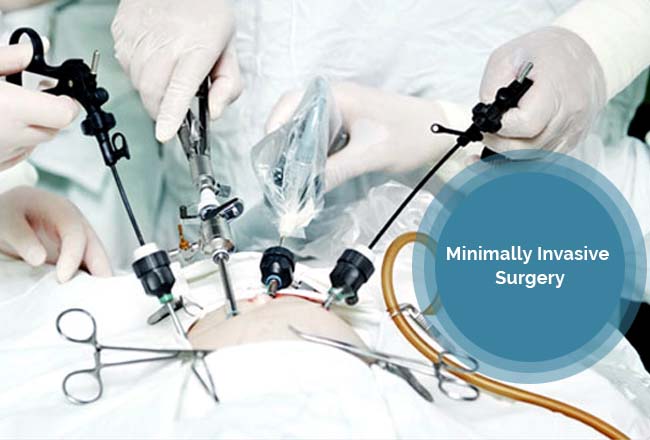 Minimally Invasive Surgery