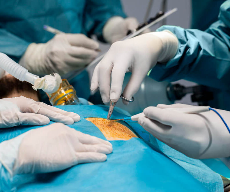 Robotic Inguinal Hernioplasty: A Modern Solution for Groin Hernias | Kaizen hospital